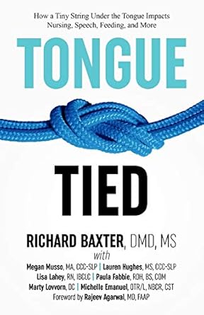 TongueTied